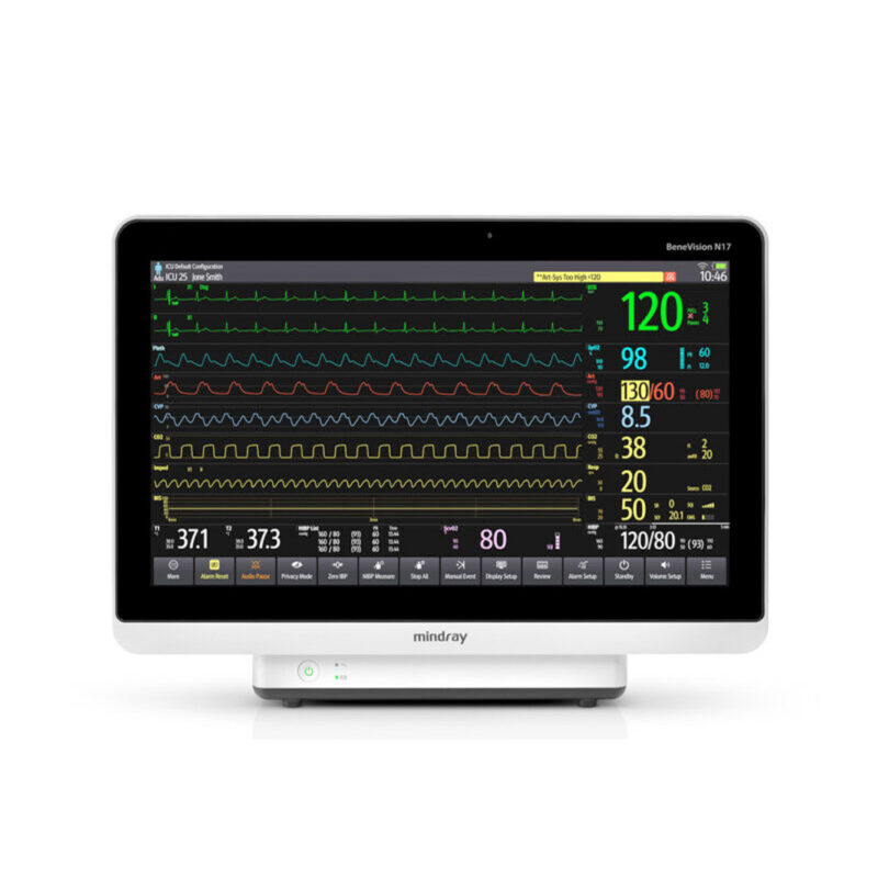 Mindray BeneVision N12, N15, & N17 Patient Monitors