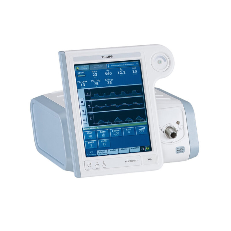 Philips Respironics V60 Ventilator